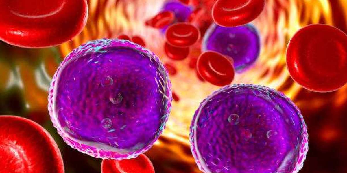 Do You Know How to Lower Your Leukemia Risk?