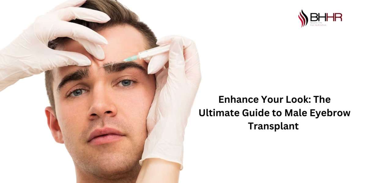 Enhance Your Look: The Ultimate Guide to Male Eyebrow Transplant